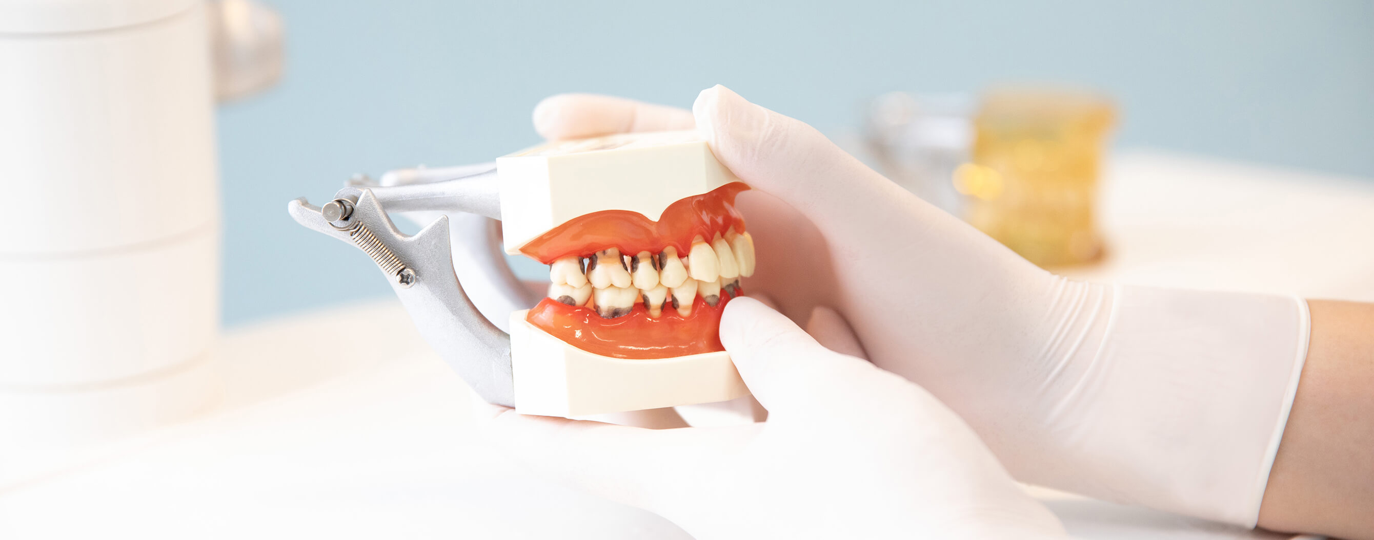 Parodontitis der Zahnarztpraxis Ingolstadt
